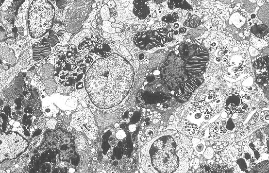  while electron microscope stains have heavy metals in them (the images 