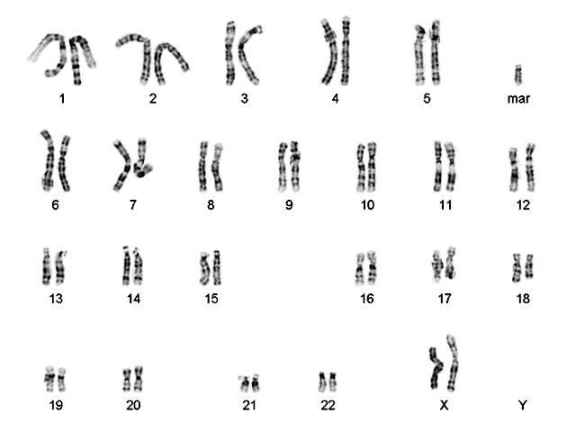 karyotype male. OF CONCEPTION KARYOTYPE