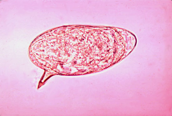 A máj schistosomiasis, Toxoplazmózis